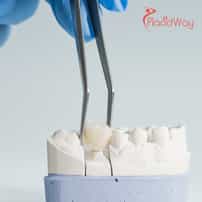 Get Your Smile Back: Affordable Dental Bridges in Thailand for New Zealanders